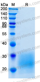 Recombinant Mouse IL22 Protein, C-His (Active)