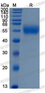 Recombinant Mouse IL1RL2/IL-36R Protein, C-His (Active)
