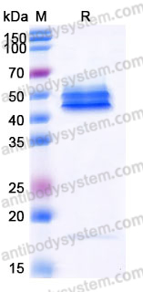 Recombinant Mouse IL23 Protein, Tag free (Active)