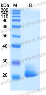 Recombinant Mouse FGF21 Protein, C-His (Active)