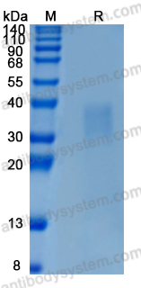 Recombinant Rat IFNB1/IFN-beta Protein, C-His (Active)
