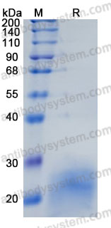 Recombinant Rat IL5 Protein, C-His (Active)