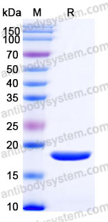 Recombinant Rat FGF2/FGFb Protein, Tag free (Active)