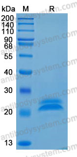 Recombinant Rat VEGFA Protein, No tag (Active)