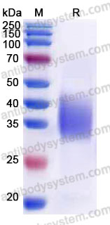 Recombinant Cynomolgus monkey CD25/IL2RA Protein, C-His (Active)