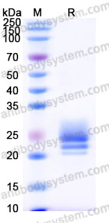 Recombinant Rhesus monkey IL6 Protein, C-His (Active)