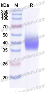 Recombinant Cynomolgus monkey CD124/IL4R/IL-4Rα Protein, C-His (Active)