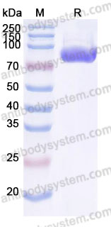 Recombinant Cynomolgus monkey CD124/IL4R/IL-4Rα Protein, C-Fc (Active)