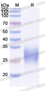 Recombinant Cynomolgus monkey IL13 Protein, C-His (Active)