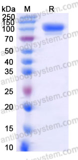 Recombinant Cynomolgus monkey CD96 Protein, C-His (Active)