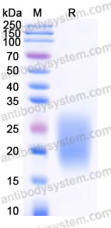 Recombinant Cynomolgus monkey GIPR (N-ECD) Protein, C-His (Active)