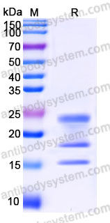 Recombinant Cynomolgus monkey IL17A Protein, C-His (Active)