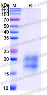 Recombinant Cynomolgus monkey TIGIT Protein, C-His (Active)