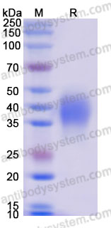 Recombinant Cynomolgus monkey CD371/CLEC12A Protein, N-His (Active)