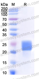 Recombinant Cynomolgus monkey CD112R/PVRIG Protein, C-His (Active)