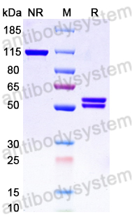 SDS-PAGE for Research Grade Galvokimig ?>