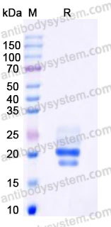 Recombinant Human CD261/TNFRSF10A Protein, C-His