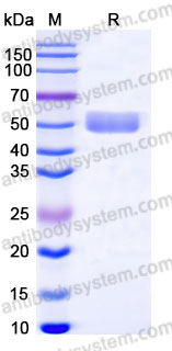 Recombinant Human CD172b/SIRPB1 Protein, C-His