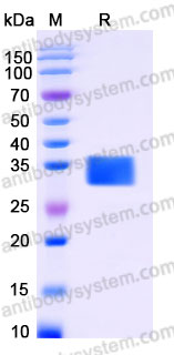 Recombinant Human CD254/RANKL Protein, N-His-Flag