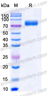 Recombinant Human CD263/TNFRSF10C Protein, C-Fc-His