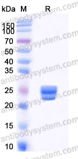 Recombinant Human CD337/NKp30 Protein, C-His