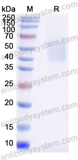 Recombinant Human NPC1 Protein, C-His
