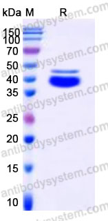 Recombinant Human CD5L Protein, C-His