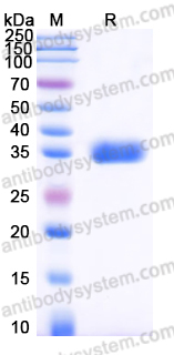 Recombinant Human KLK8 Protein, C-His
