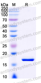 Recombinant Human ZG16 Protein, C-His