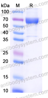 Recombinant Human CD16b/FCGR3B Protein, C-Fc