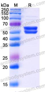 Recombinant Human SERPINI2 Protein, C-His