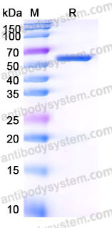 Recombinant Human CD218b/IL18RAP Protein, C-His