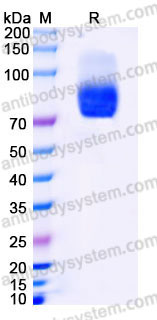 Recombinant Human CD218b/IL18RAP Protein, C-Fc-His