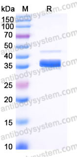 Recombinant Human CD336/NCR2 Protein, C-His