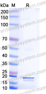 SDS-PAGE for Recombinant Human AGR2/HPC8 Protein, C-His ?>