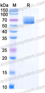 Recombinant Human IL18BP Protein, C-Fc