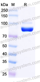 Recombinant Human F13A1 Protein, C-His