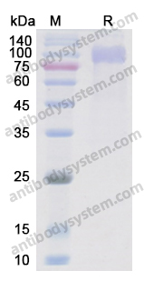 Recombinant Human EGFR/ERBB1/HER1 Protein, C-His