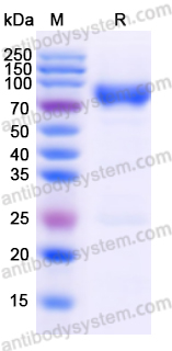 Recombinant Human PIVKA-II/DCP Protein, C-His