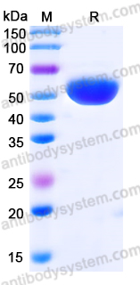 Recombinant Human a1AT/Serpin A1/SERPINA1 Protein, C-His