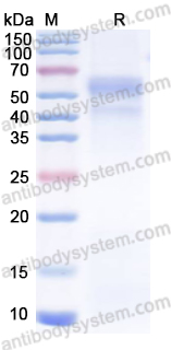 Recombinant Human TGFB1/TGF-beta-1 Protein, C-His