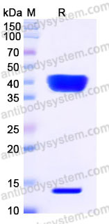 Recombinant Human Latent TGF-beta-1 Protein, N-His