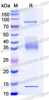 Recombinant Human Latent TGF-beta-1 & GARP Complex Protein, N-His & C-3*Strep
