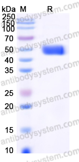 Recombinant Human LRG1 Protein, C-His