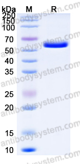 Recombinant Human AHSG Protein, C-His
