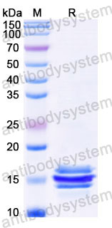 Recombinant Human PPBP/CXCL7/NAP-2 Protein, C-His