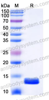 Recombinant Human PF4/CXCL4 Protein, C-His