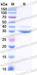 Recombinant Human CXCL10/IP-10 Protein, C-Fc-His
