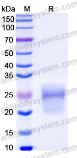 Recombinant Human CD3D Protein, C-His
