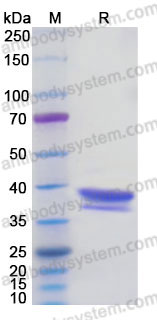 Recombinant Human ARG1/Arginase-1 Protein, C-His